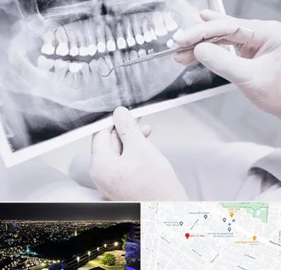 رادیولوژی دهان و دندان در هفت تیر مشهد