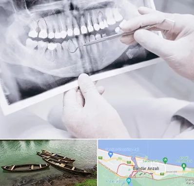 رادیولوژی دهان و دندان در بندر انزلی