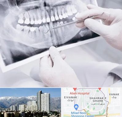 رادیولوژی دهان و دندان در شهرک غرب 