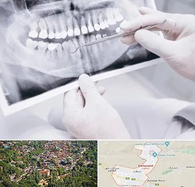 رادیولوژی دهان و دندان در دماوند