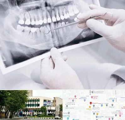 رادیولوژی دهان و دندان در طالقانی
