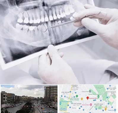 رادیولوژی دهان و دندان در بلوار فردوسی مشهد