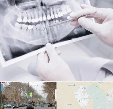 رادیولوژی دهان و دندان در نظرآباد کرج