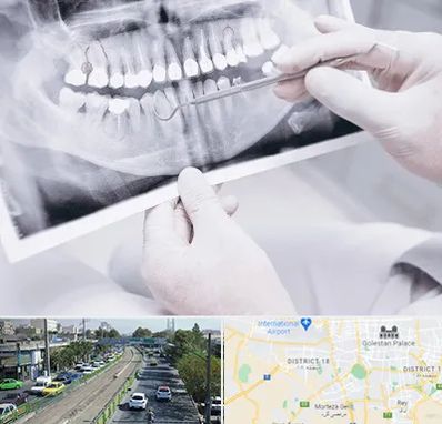 رادیولوژی دهان و دندان در جنوب تهران 