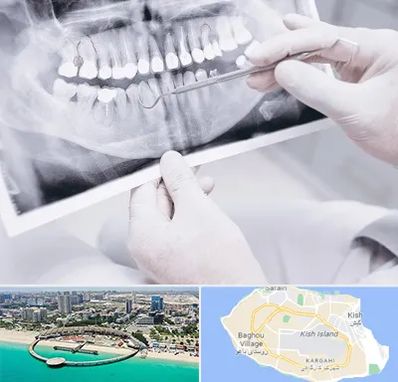 رادیولوژی دهان و دندان در کیش