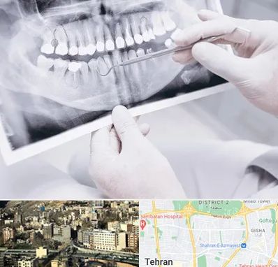 رادیولوژی دهان و دندان در مرزداران 