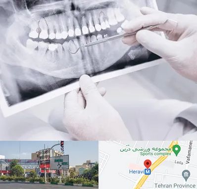 رادیولوژی دهان و دندان در هروی 
