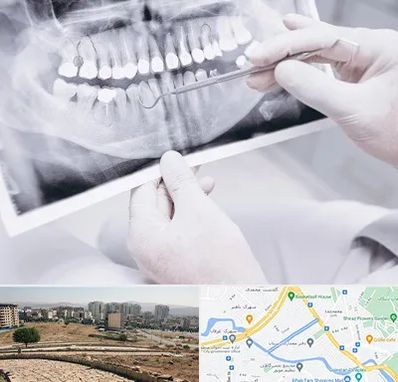 رادیولوژی دهان و دندان در کوی وحدت شیراز
