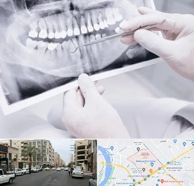 رادیولوژی دهان و دندان در زیتون کارمندی اهواز