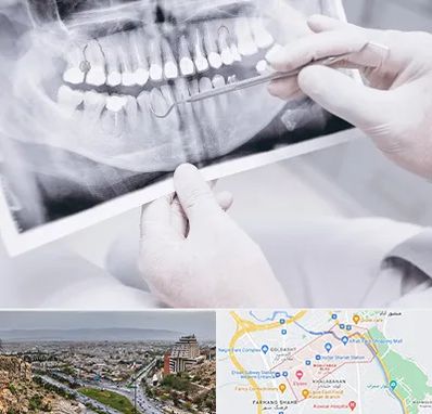 رادیولوژی دهان و دندان در معالی آباد شیراز
