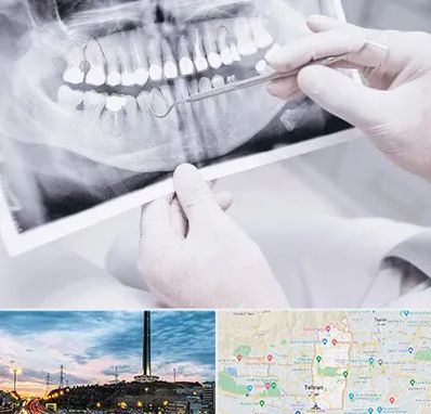 رادیولوژی دهان و دندان در منطقه 2 تهران