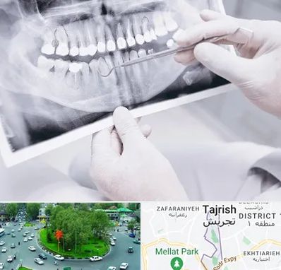 رادیولوژی دهان و دندان در تجریش 