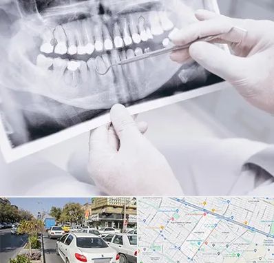 رادیولوژی دهان و دندان در مفتح مشهد
