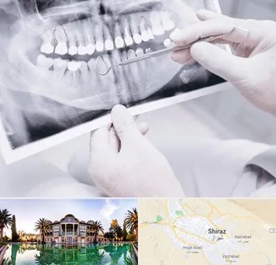 رادیولوژی دهان و دندان در شیراز