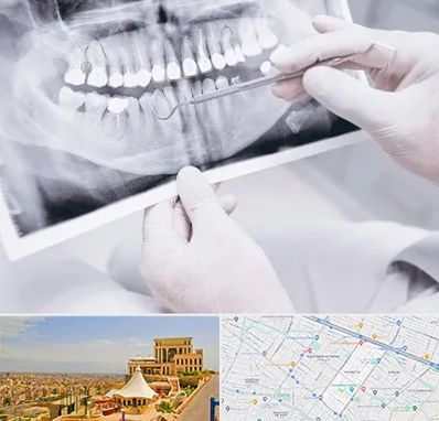 رادیولوژی دهان و دندان در هاشمیه مشهد