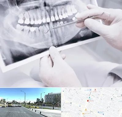 رادیولوژی دهان و دندان در بلوار کلاهدوز مشهد