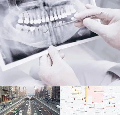 رادیولوژی دهان و دندان در توحید