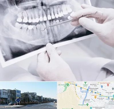 رادیولوژی دهان و دندان در شریعتی مشهد