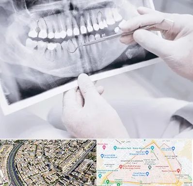 رادیولوژی دهان و دندان در شهرک غرب مشهد