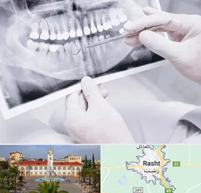 رادیولوژی دهان و دندان در رشت