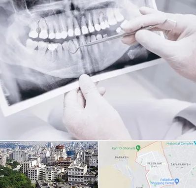 رادیولوژی دهان و دندان در ولنجک 