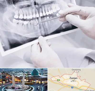 رادیولوژی دهان و دندان در زنجان
