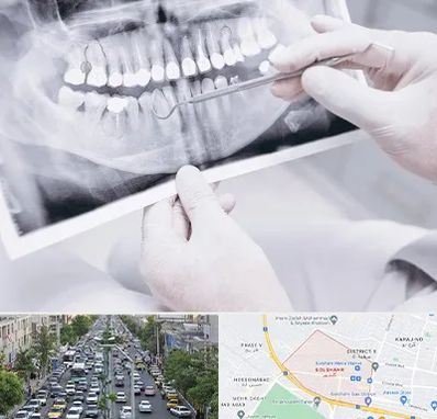 رادیولوژی دهان و دندان در گلشهر کرج