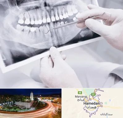 رادیولوژی دهان و دندان در همدان