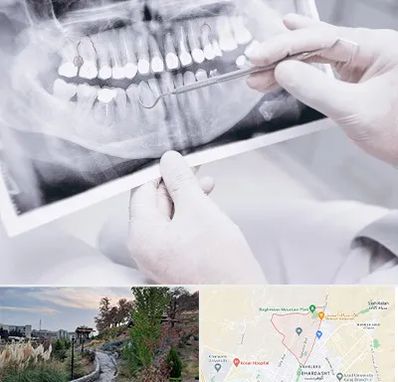 رادیولوژی دهان و دندان در باغستان کرج
