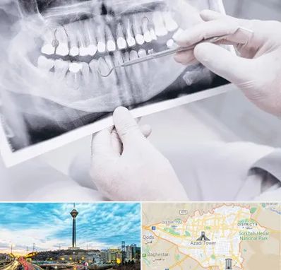 رادیولوژی دهان و دندان در تهران