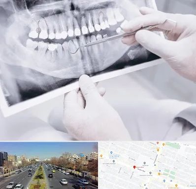 رادیولوژی دهان و دندان در بلوار معلم مشهد