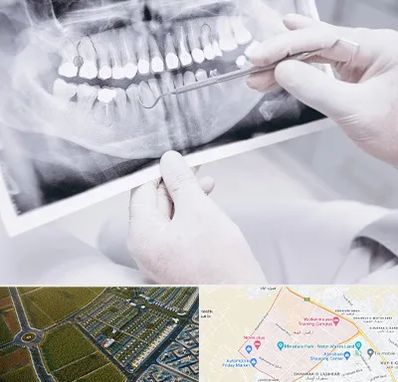 رادیولوژی دهان و دندان در الهیه مشهد
