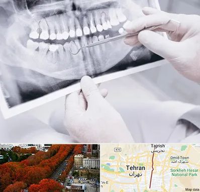 رادیولوژی دهان و دندان در ولیعصر 