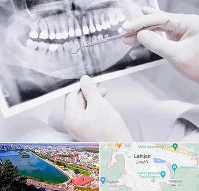 رادیولوژی دهان و دندان در لاهیجان
