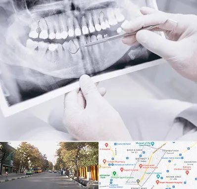 رادیولوژی دهان و دندان در شریعتی 