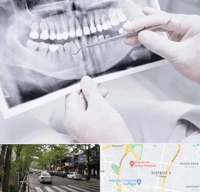 رادیولوژی دهان و دندان در ظفر 