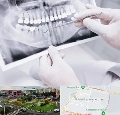 رادیولوژی دهان و دندان در تهرانسر 