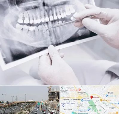 رادیولوژی دهان و دندان در بلوار توس مشهد