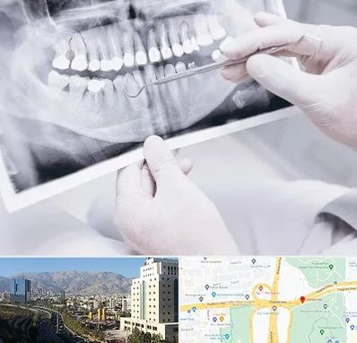 رادیولوژی دهان و دندان در حقانی