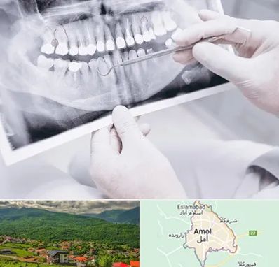 رادیولوژی دهان و دندان در آمل