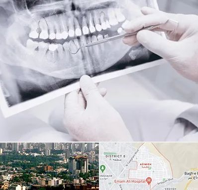 رادیولوژی دهان و دندان در عظیمیه کرج 