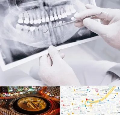 رادیولوژی دهان و دندان در میدان ولیعصر