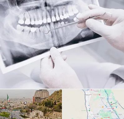 رادیولوژی دهان و دندان در فرهنگ شهر شیراز