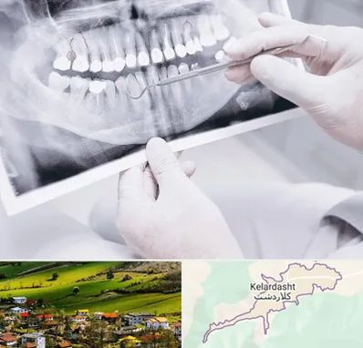 رادیولوژی دهان و دندان در کلاردشت