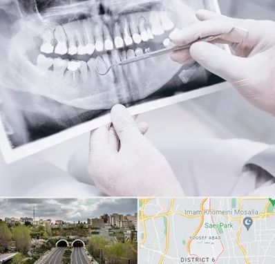 رادیولوژی دهان و دندان در یوسف آباد 