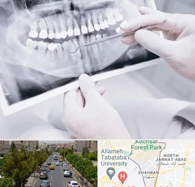 رادیولوژی دهان و دندان در شهران 