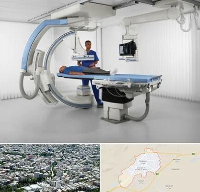 فلوروسکوپی در شاهرود
