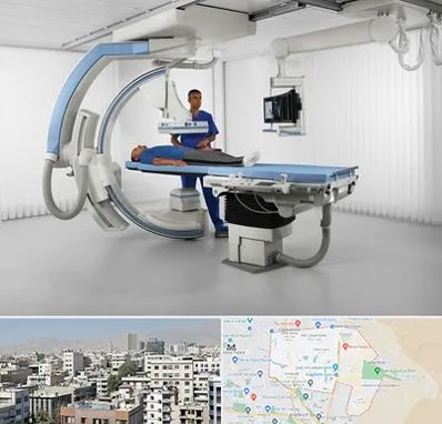 فلوروسکوپی در منطقه 14 تهران