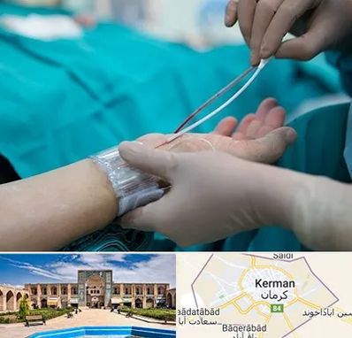 آنژیوگرافی در کرمان