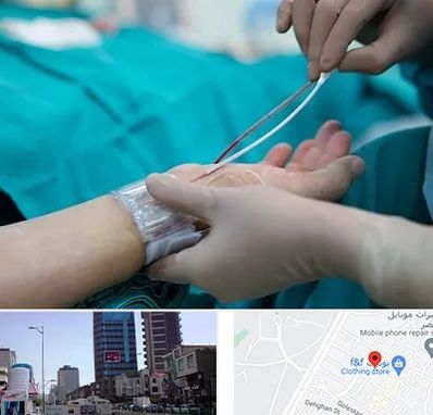 آنژیوگرافی در چهارراه طالقانی کرج